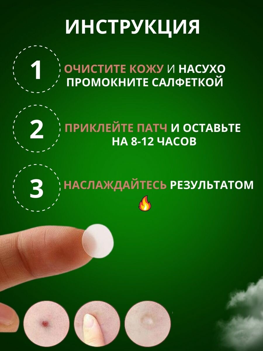 Патчи CareProff против прыщей, салициловая кислота, для всех типов кожи, 72 штуки, против акне, маска для губ — фото 1