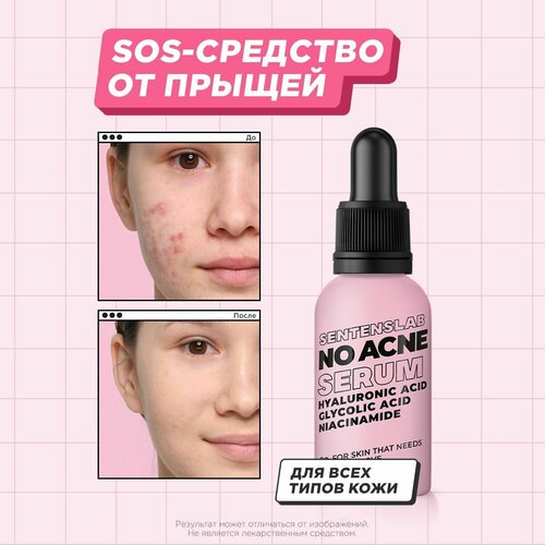SENTENSLAB /Сыворотка для лица с гликолевой кислотой ниацинамидом против прыщей акне угрей для проблемной кожи