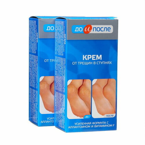 Крем для ног от трещин в ступнях, 2 шт по 150 мл