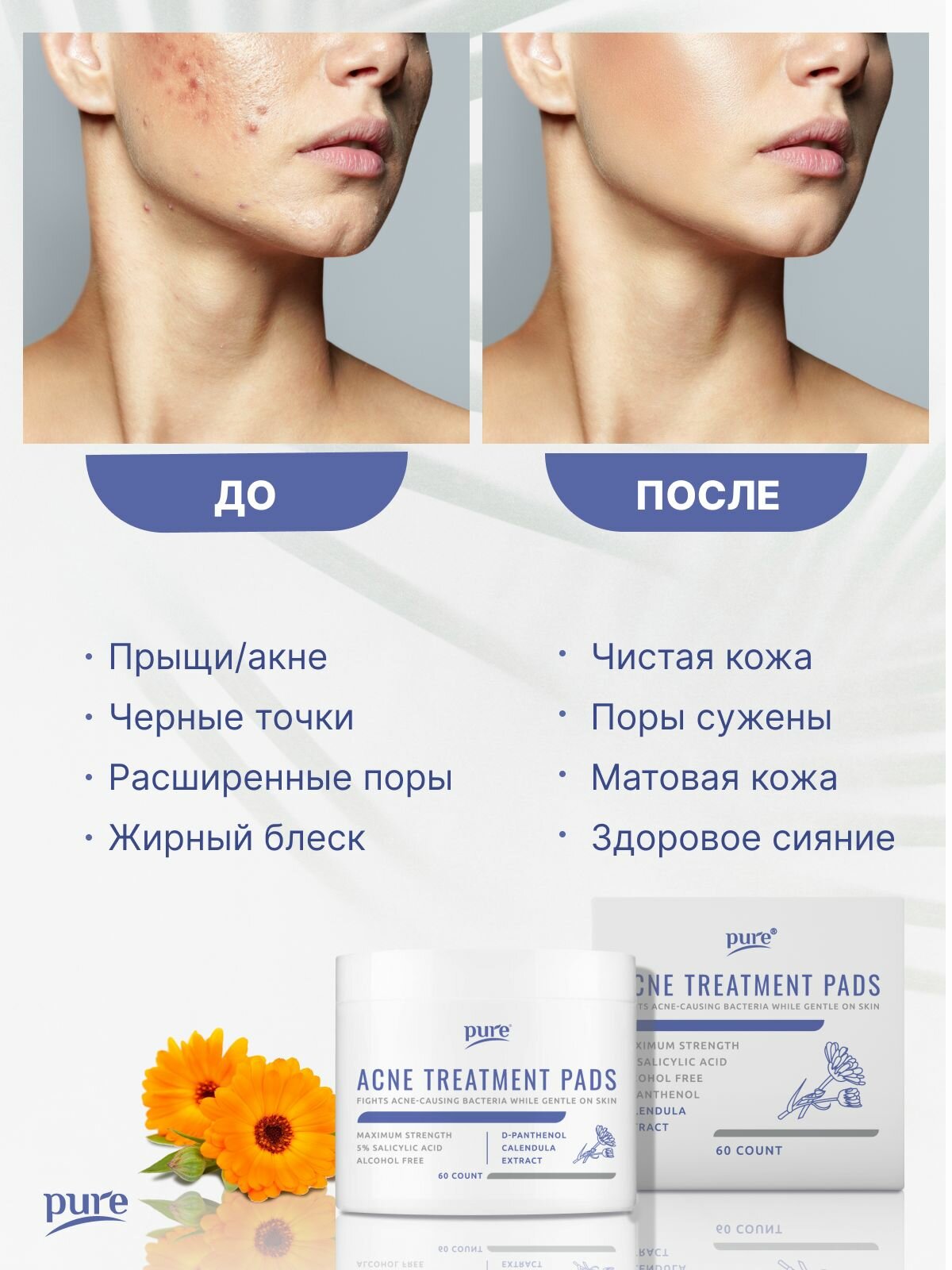 Пилинг-пэды Pure салициловые диски от прыщей акне, 60 шт. — фото 1