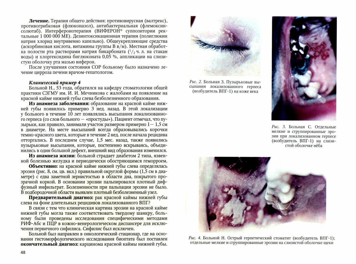 Герпесвирусная инфекция. особенности проявления в челюстно-лицевой области. Учебное пособие - фото №2