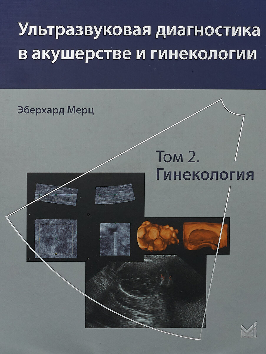 Ультразвуковая диагностика в акушерстве и гинекологии. Том 2. Гинекология