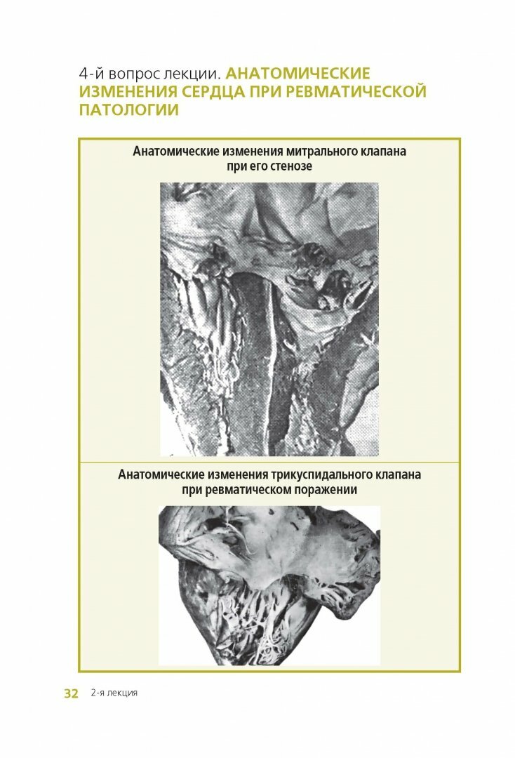 Клиническая анатомия сердца. Иллюстрированный авторский цикл лекций - фото №9