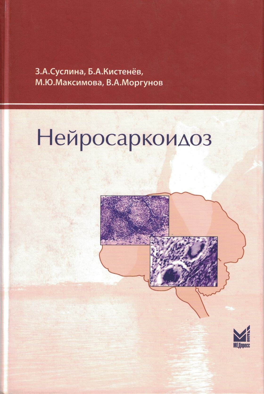 Нейросаркоидоз (Суслина З.А., Кистенёв Б.А., Максимова М.Ю., Моргунов В.А.) - фото №2