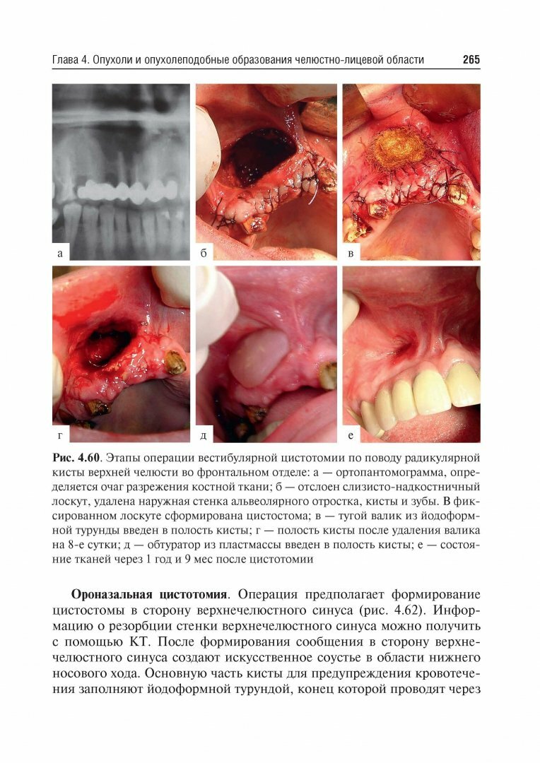 Стоматология. Учебник для ВУЗов - фото №17