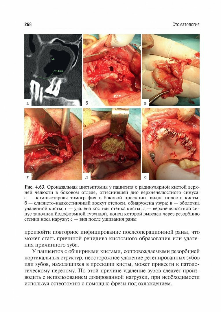 Стоматология. Учебник для ВУЗов - фото №18
