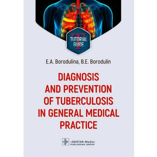 Diagnosis and prevention of tuberculosis in general medical