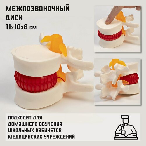 Изображение товара Макет "Межпозвонковый диск" 11*10*8см