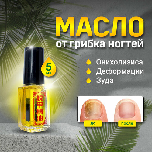Масло для ногтей средство для лечения грибка и онихолизиса, SilaVeres, 5 мл