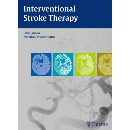 Olav Jansen "Interventional Stroke Therapy"