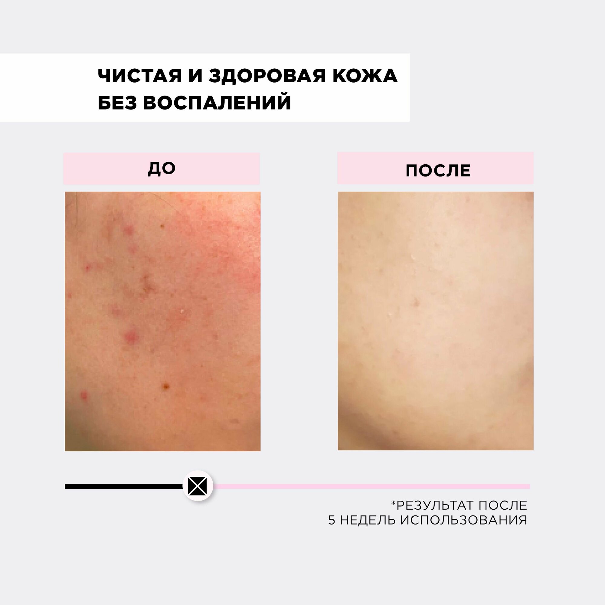 Mixit Your Skin Enzyme Powder Энзимная пудра для умывания с папаином и растительными экстрактами