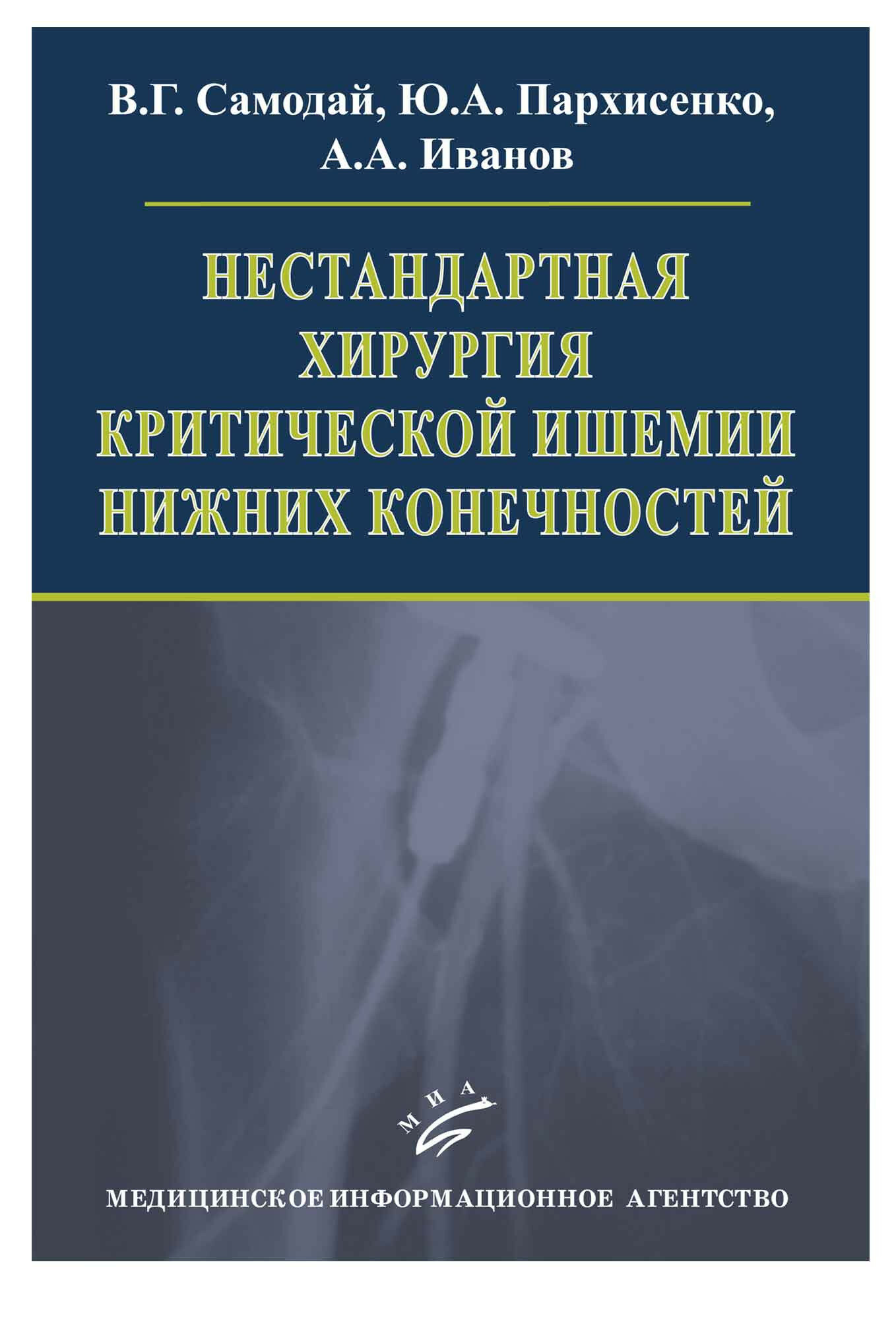 Нестандартная хирургия критической ишемии нижних конечностей