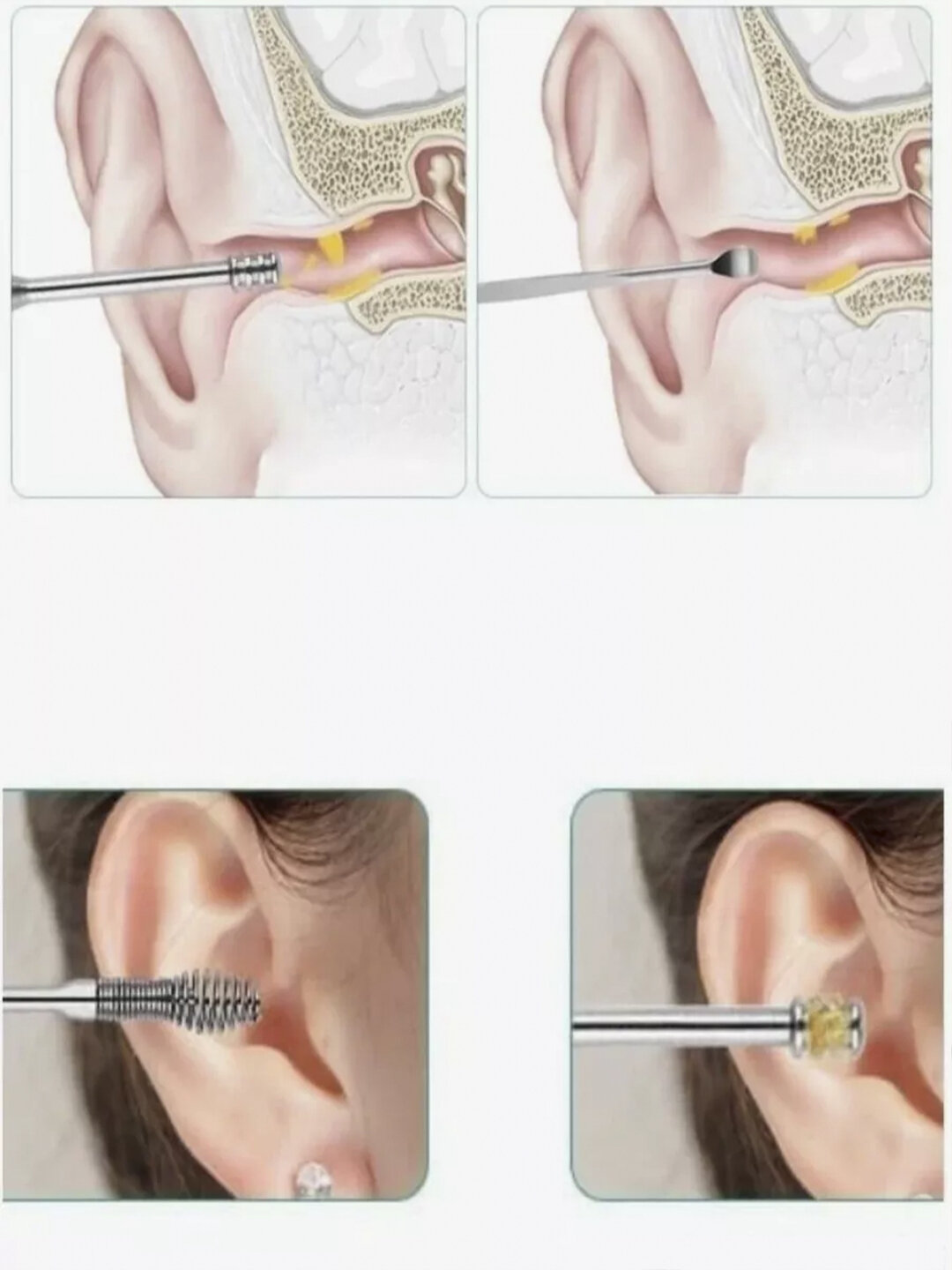 Набор для чистки ушей, пластик, безопасные инструменты из нержавеющей стали, 5 в 1 — фото 1