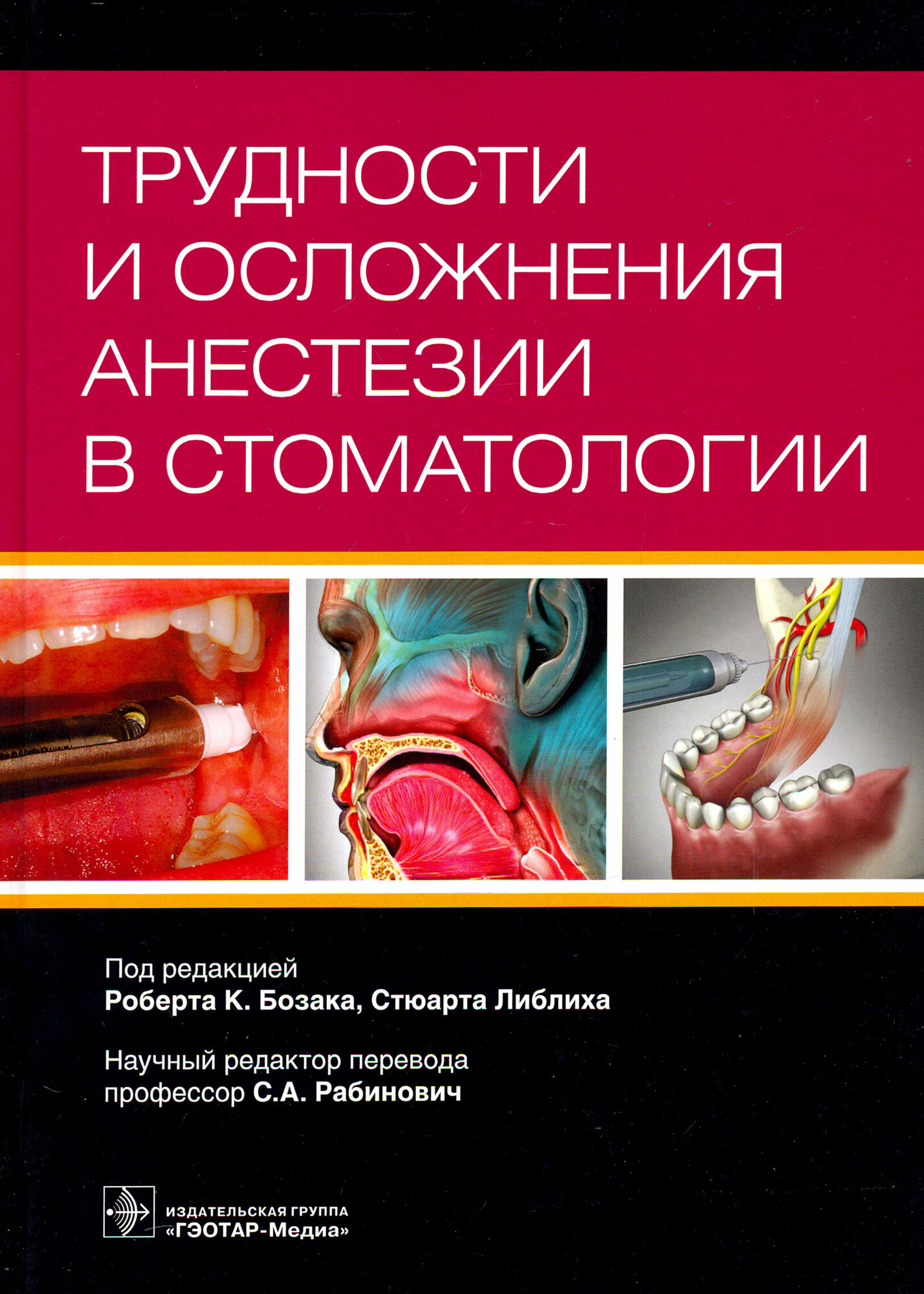 Трудности и осложнения анестезии в стоматологии - фото №11