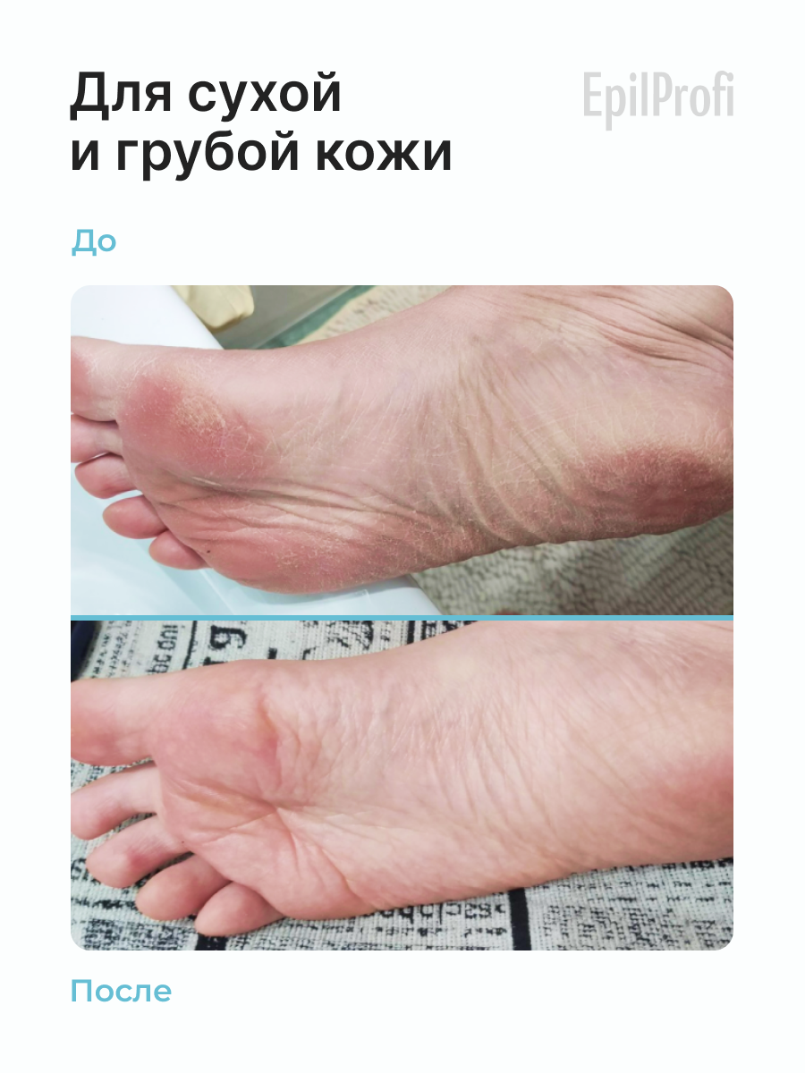 Изображение Крем для ног EpilProfi с мочевиной от трещин и натоптышей с витамином Е, F, 500 мл