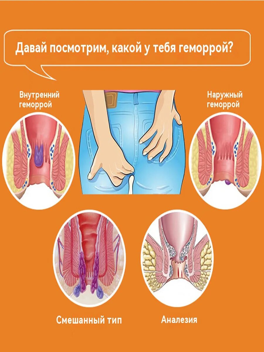 Картинки Мазь от геморроя 20 грамм