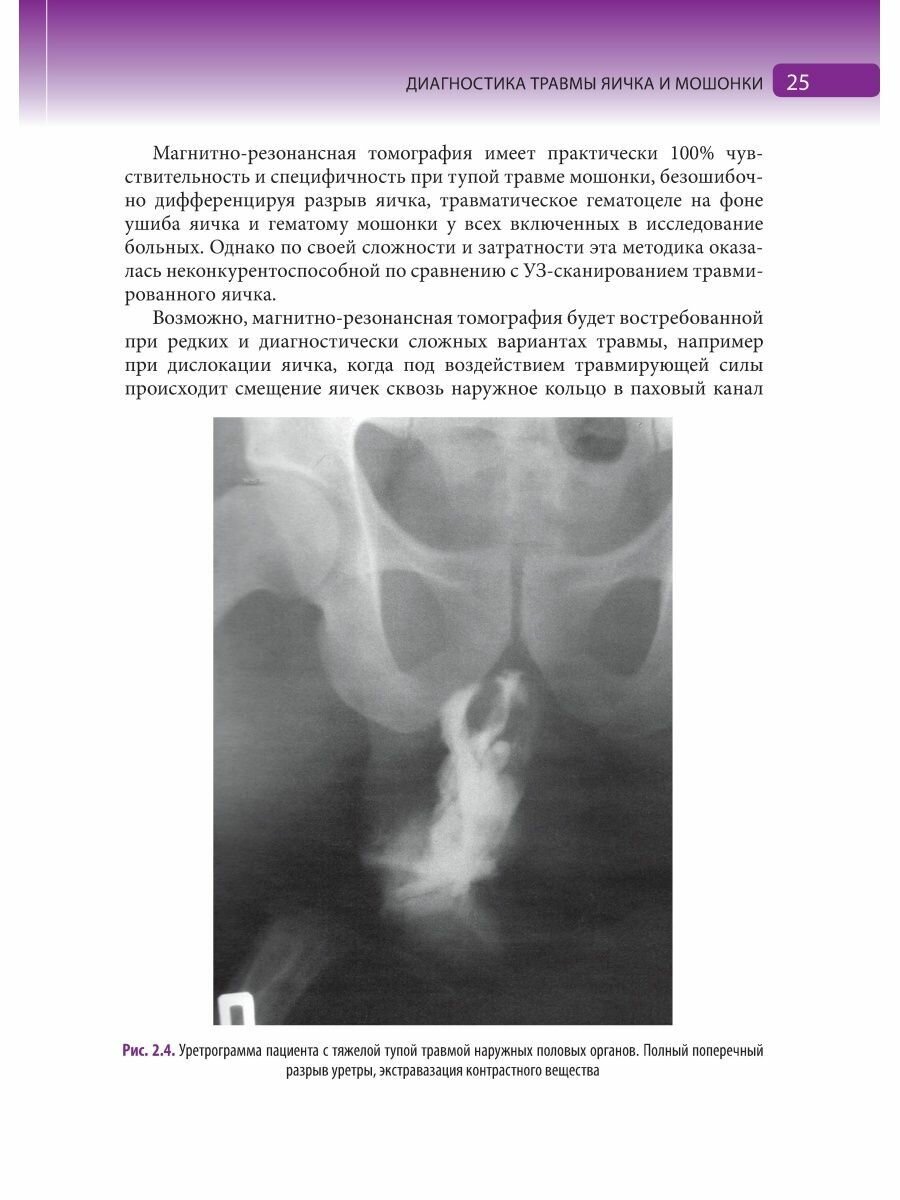 Травмы органов мошонки. Иллюстрированное руководство - фото №14