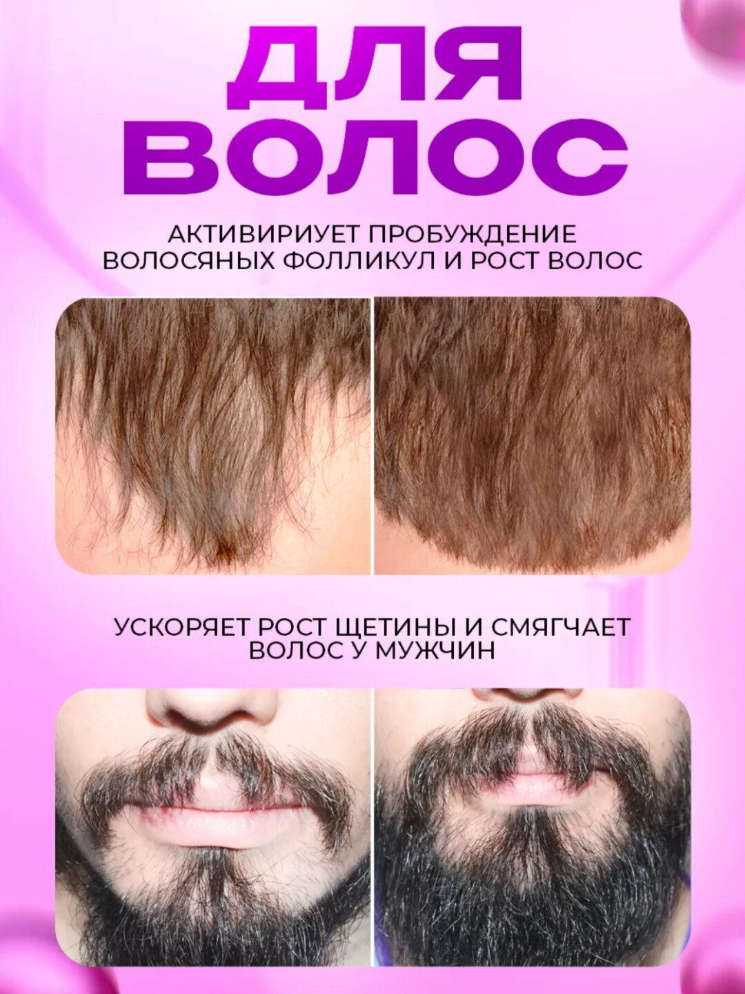 Дермороллер для усиления действия миноксидила, мезороллер — фото 1