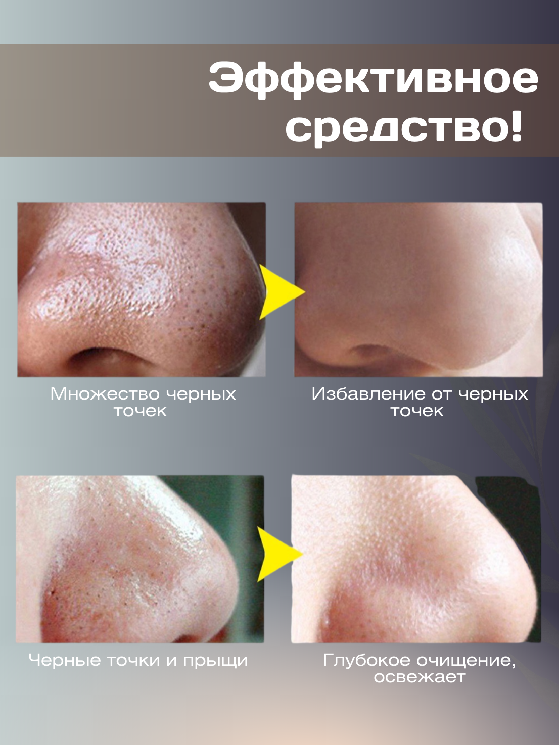 Маска для лица против прыщей LANBENA, универсальная, с эффектом увлажнения — фото 1
