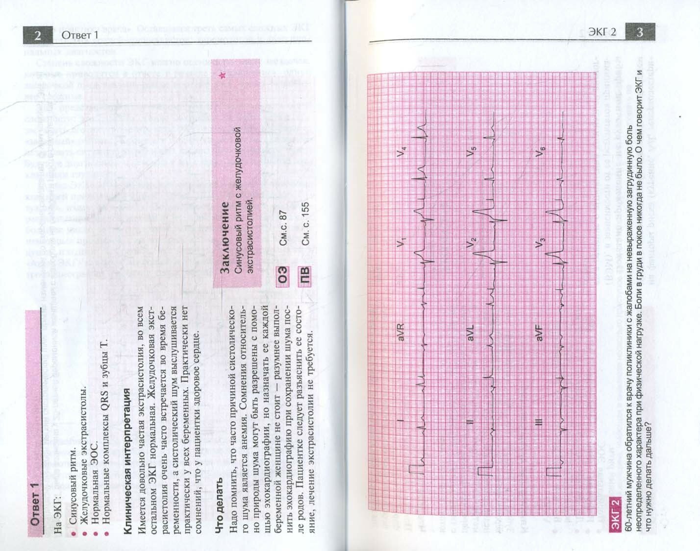 Атлас ЭКГ. 150 клинических ситуаций - фото №2