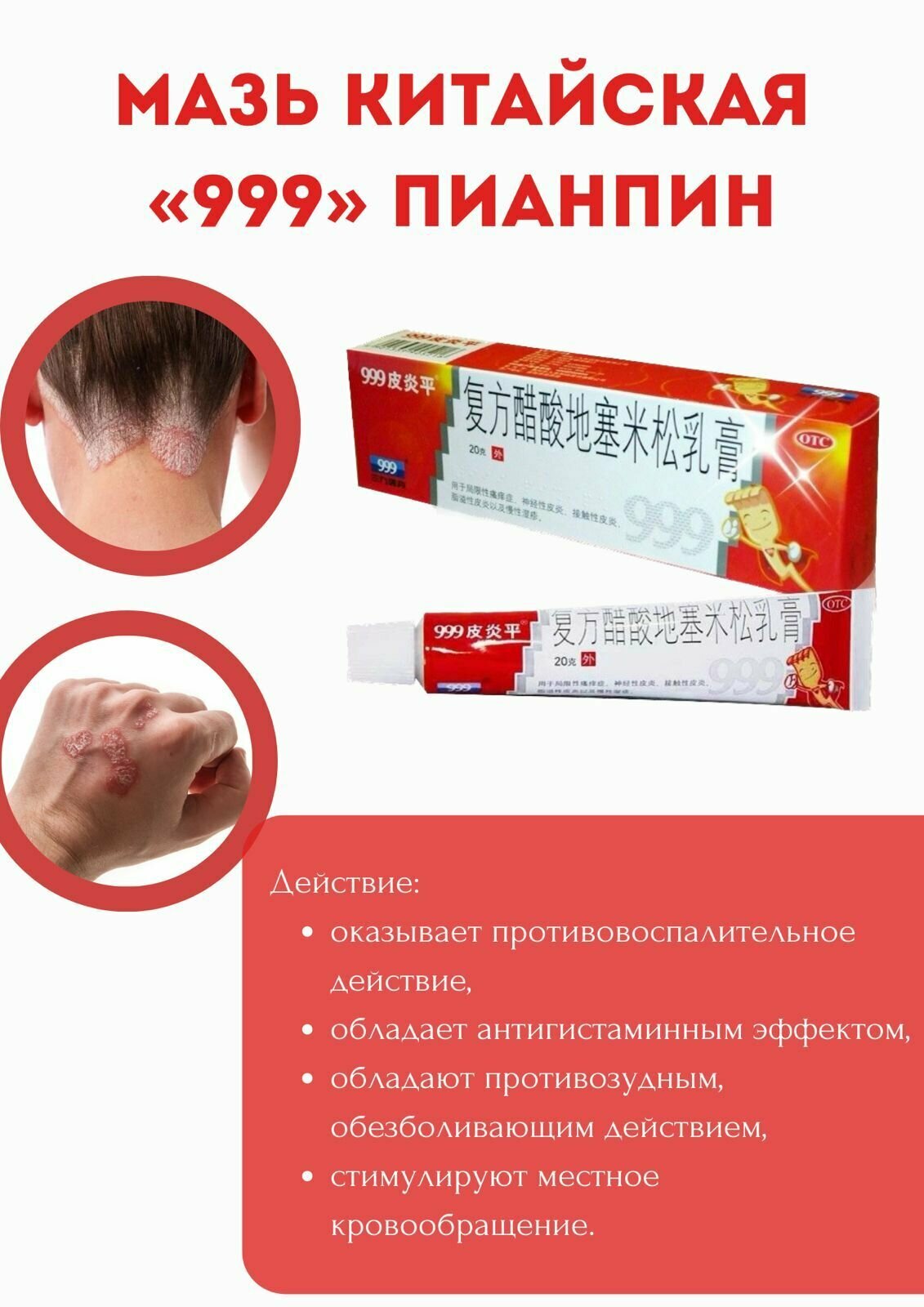 Изображение Китайская антисептическая мазь Пианпин 999 от дерматита / от псориаза