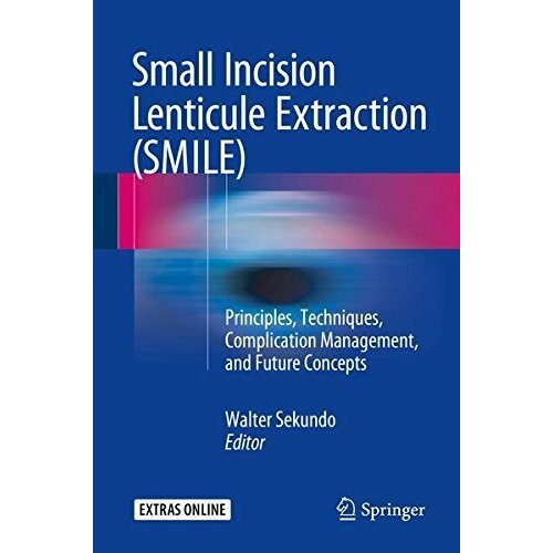Walter Sekundo "Small Incision Lenticule Extraction (SMILE)"