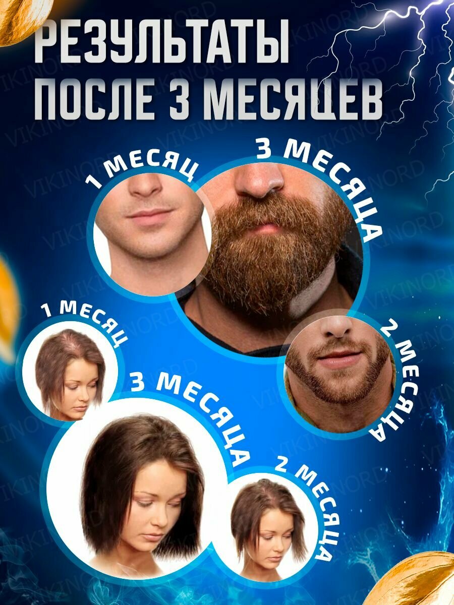 Лосьон Vikinord 5% (2 шт) для роста волос и бороды + Пипетка — фото 1