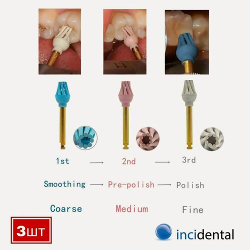 Изображение товара NeoHealth Трехступенчатая система OCCLUFLEX , Полировка, Предварительная, до зеркального блеска, композитных и гибридных керамических 3шт