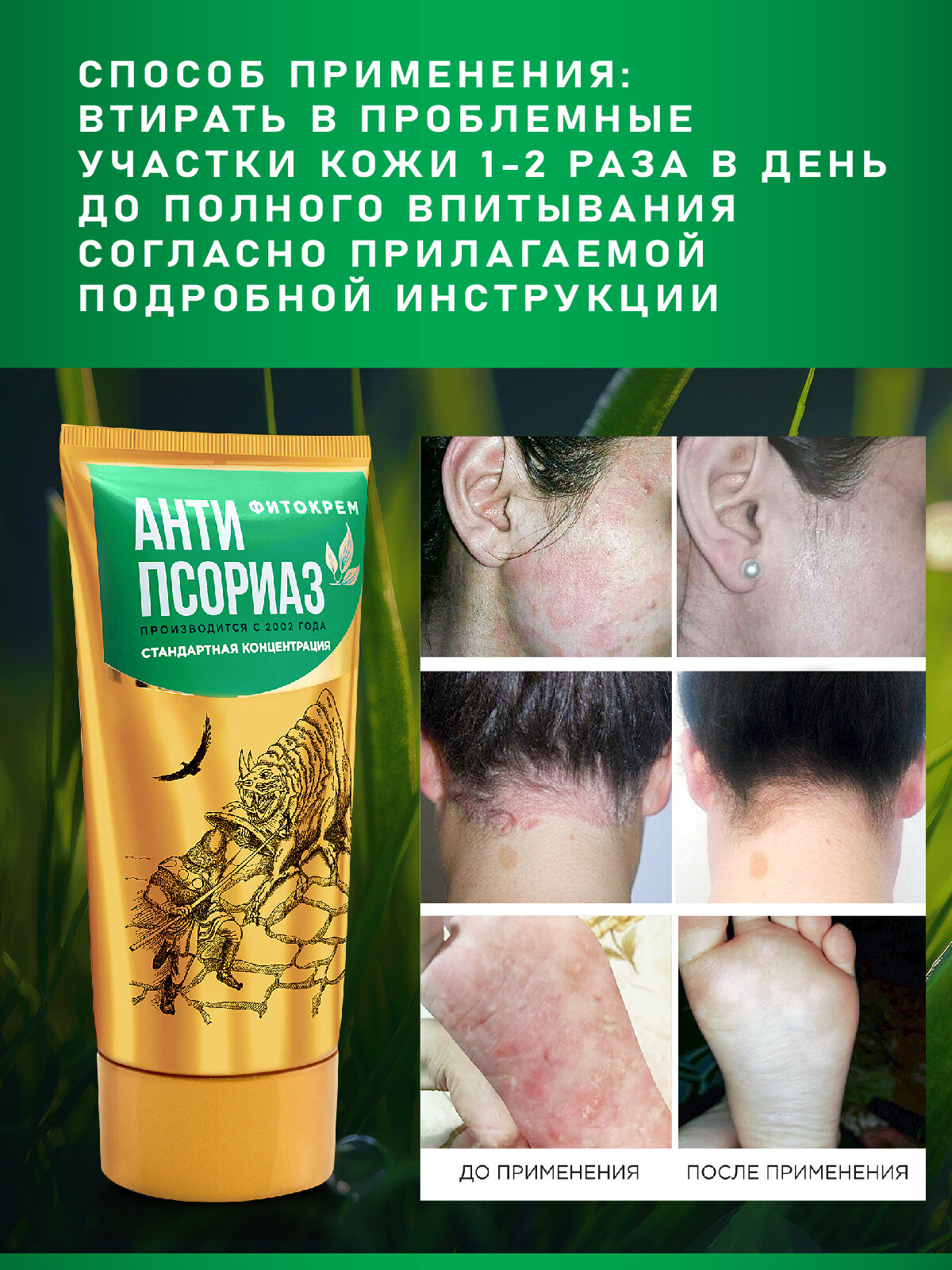 Фитокрем Антипсориаз Классический, 130 мл — фото 1