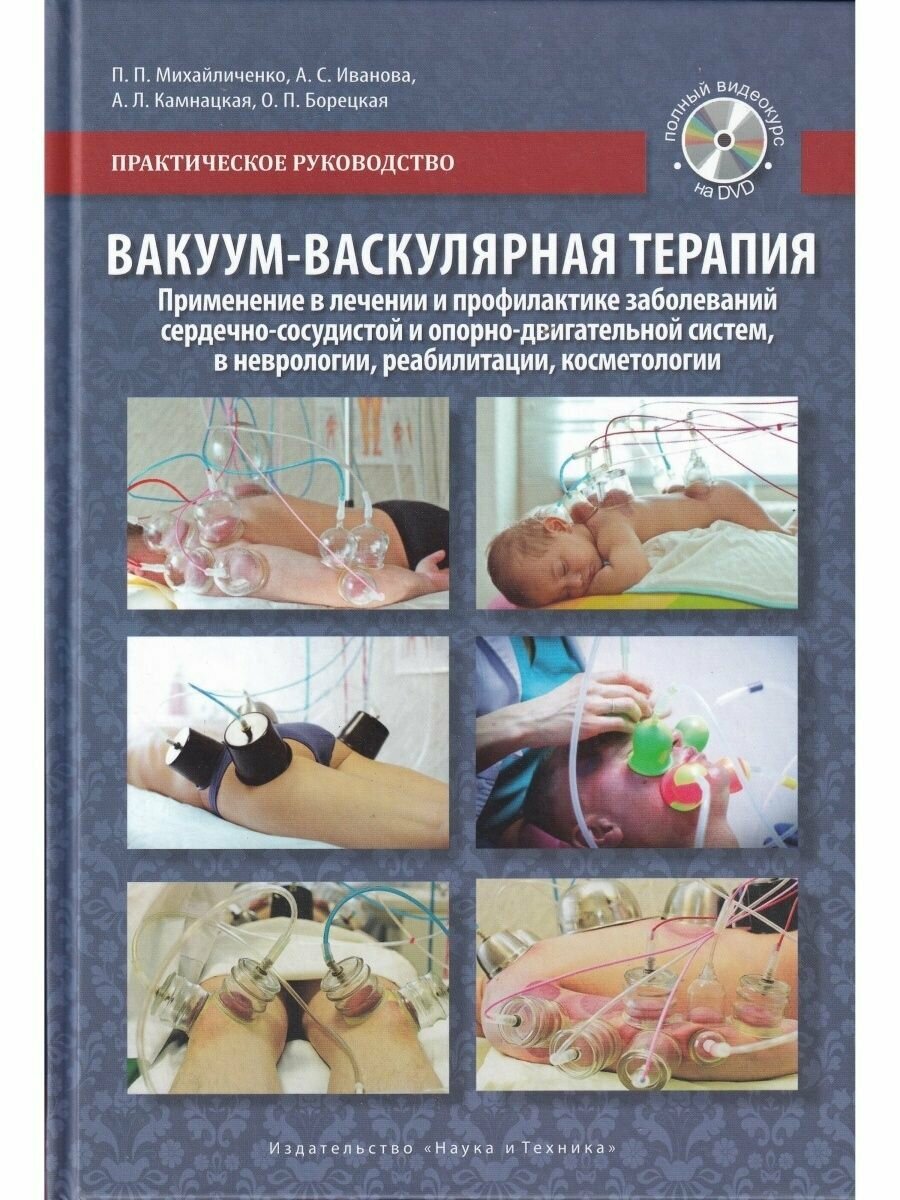 Вакуум-васкулярная терапия Применение в лечении и профилактике заболеваний сердечно-сосудистой и опорно-двигательной систем в неврологии реабилитации косметологии DVD - фото №7