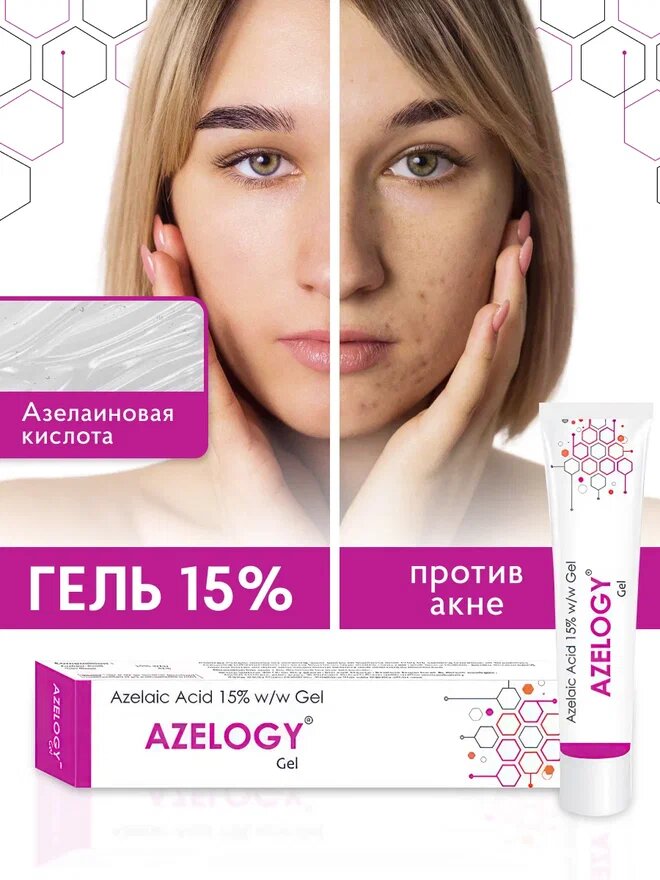 Гель азелоджи с азелаиновой кислотой 15% от прыщей для всех типов кожи, 30 гр — фото 1