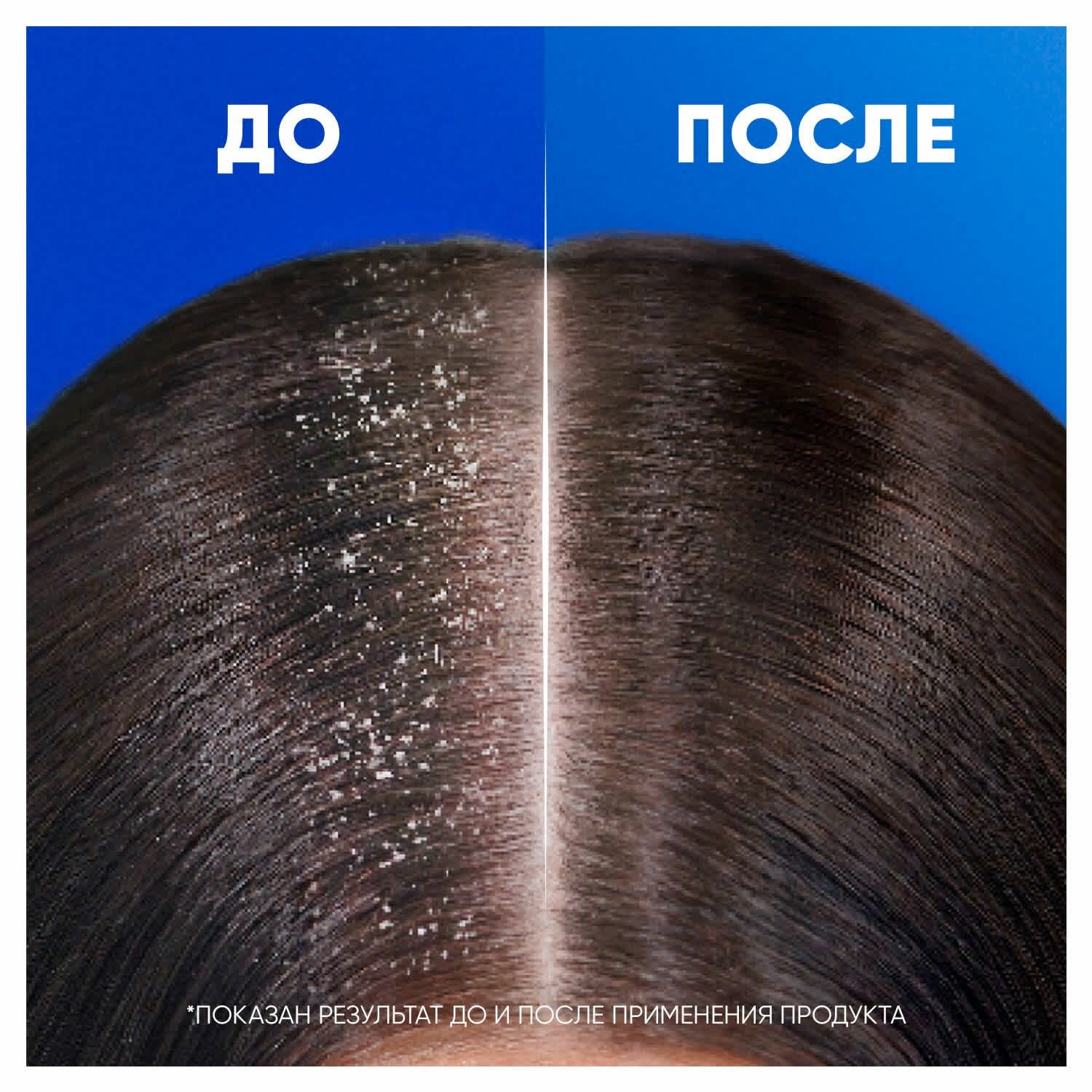 Head&Shoulders Шампунь против перхоти Увлажняющий уход 400мл — фото 1