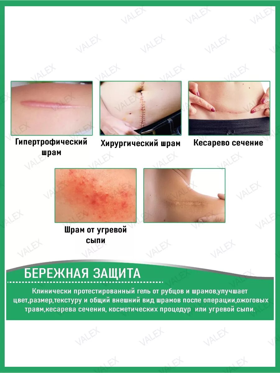 Картинки Пластырь ALIVER, силиконовый, от шрамов, рубцов, бежевый 4*150см