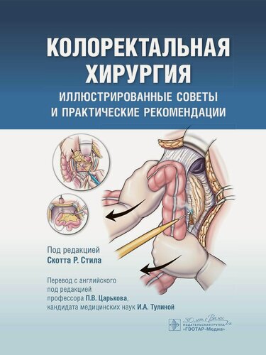 Изображение товара Колоректальная хирургия. Иллюстрированные советы и практические рекомендации