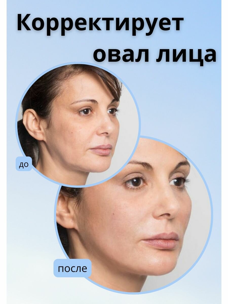 Бандаж для лица и подбородка, маска подтягивающая для коррекции овала лица, для контуринга скул. Компрессионная. Размер Универсальный. зеленый — фото 1