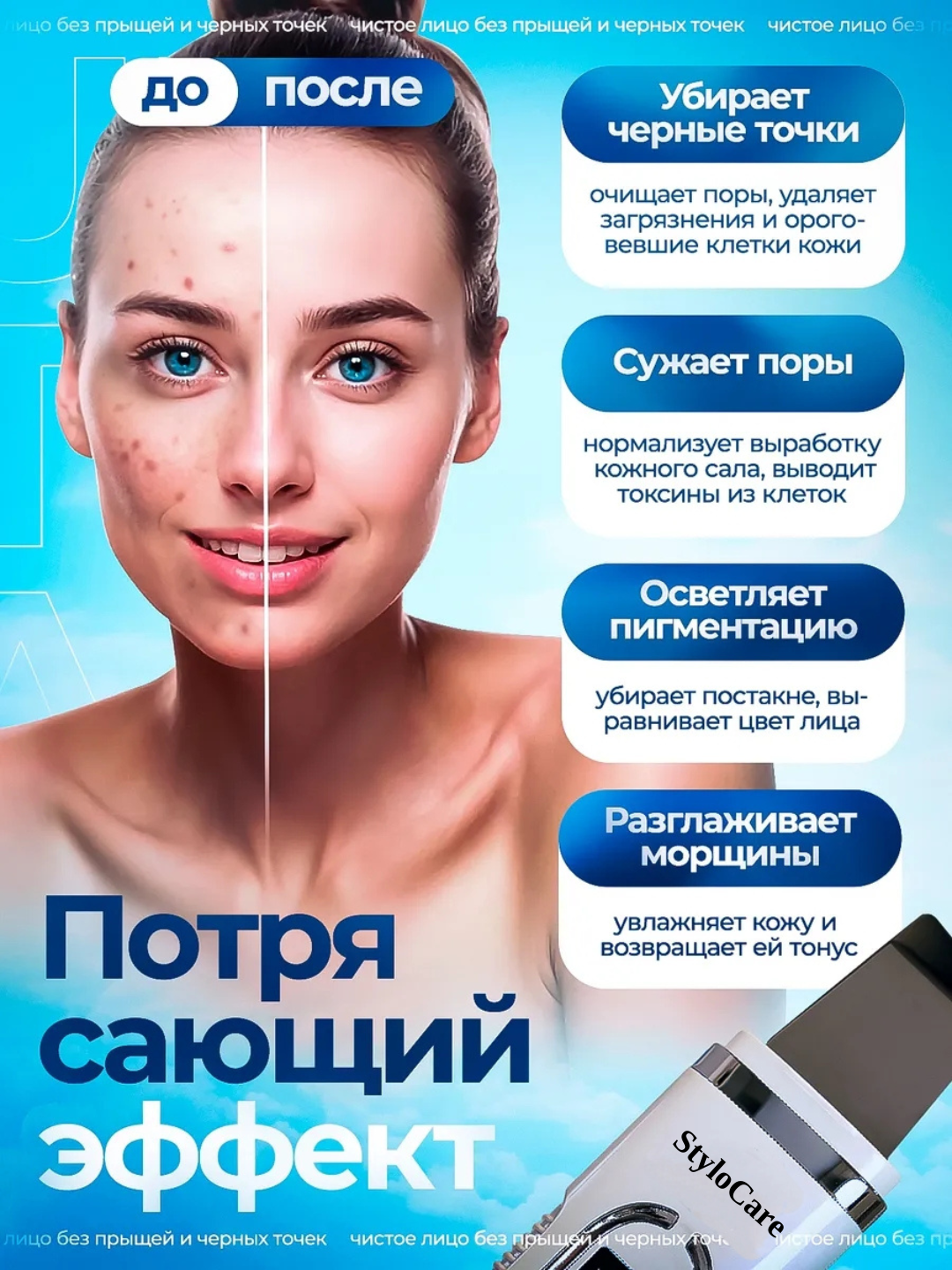 Аппарат для ультразвуковой чистки лица — фото 1