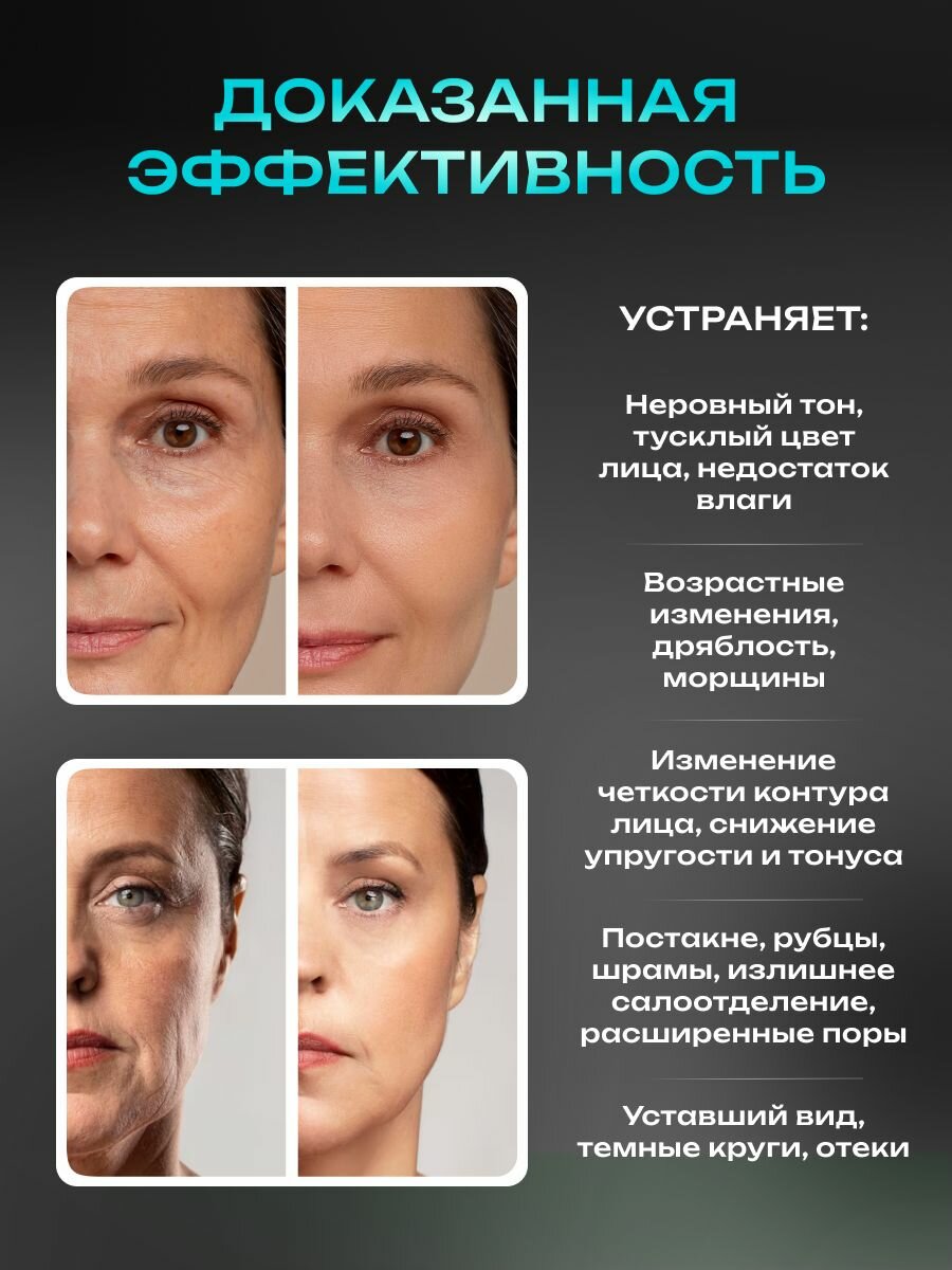 Микротоковый массажер для лица MC-5, rf лифтинг аппарат, микротоки для лица, вибромассажер, светотерапия — фото 1