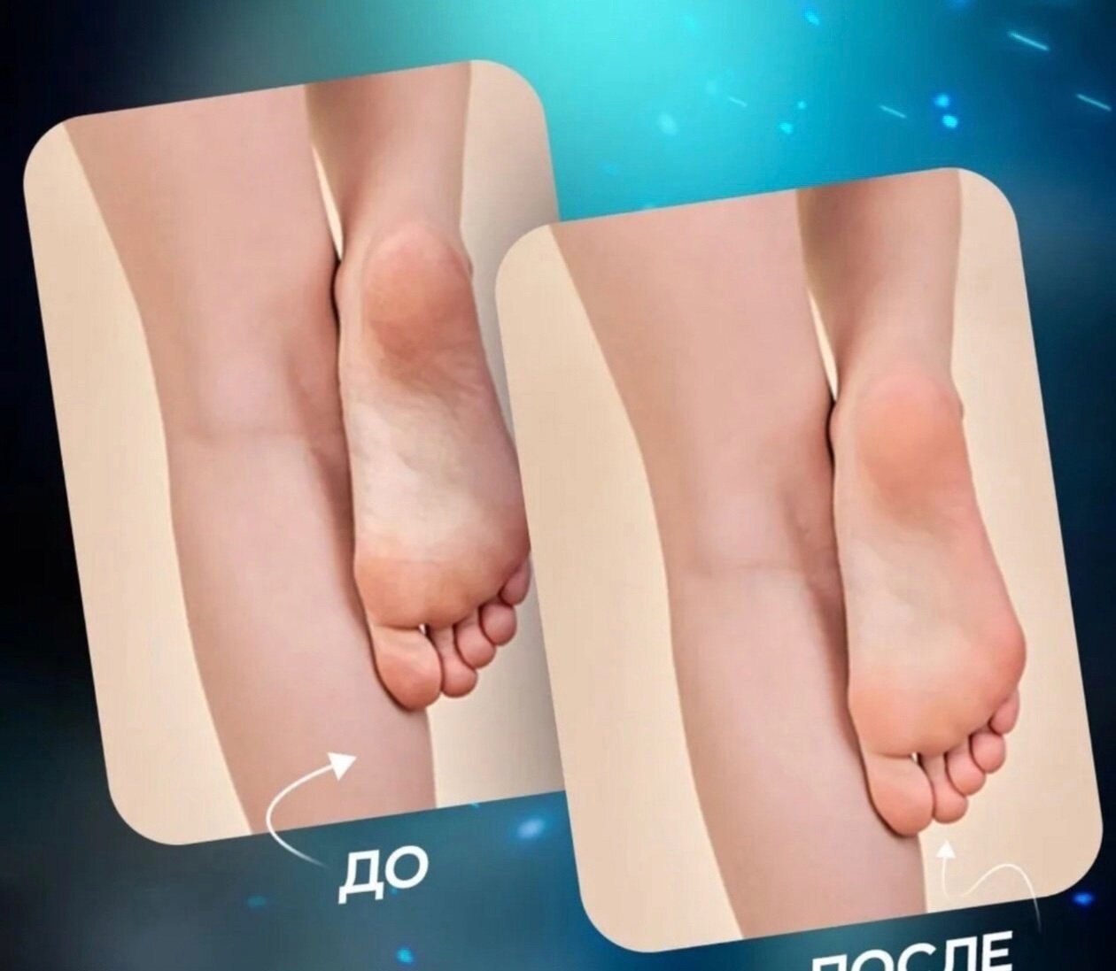 Пилки Электрические Электрическая беспроводная роликовая пилка для пяток, электропилка для педикюра, педикюрный домашний аппарат