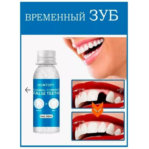 Материал пломбировочный временный (HOMTOPY). Пломба зубная для ремонта и самостоятельного изготовления, временные накладные и вставные зубы и виниры для зубов