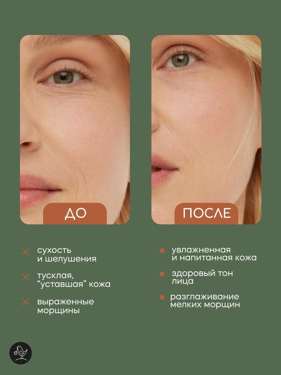 Сыворотка для лица "С гиалуроновой кислотой", для сухой и нормальной кожи, 30 мл — фото 1