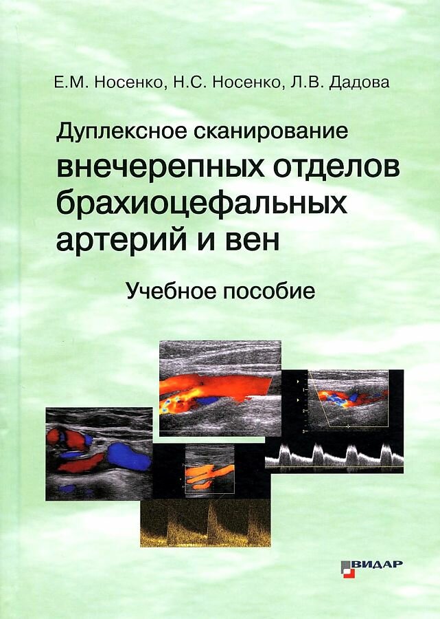 Дуплексное сканирование внечерепных отделов брахиоцефальных артерий и вен. Методика исследования.