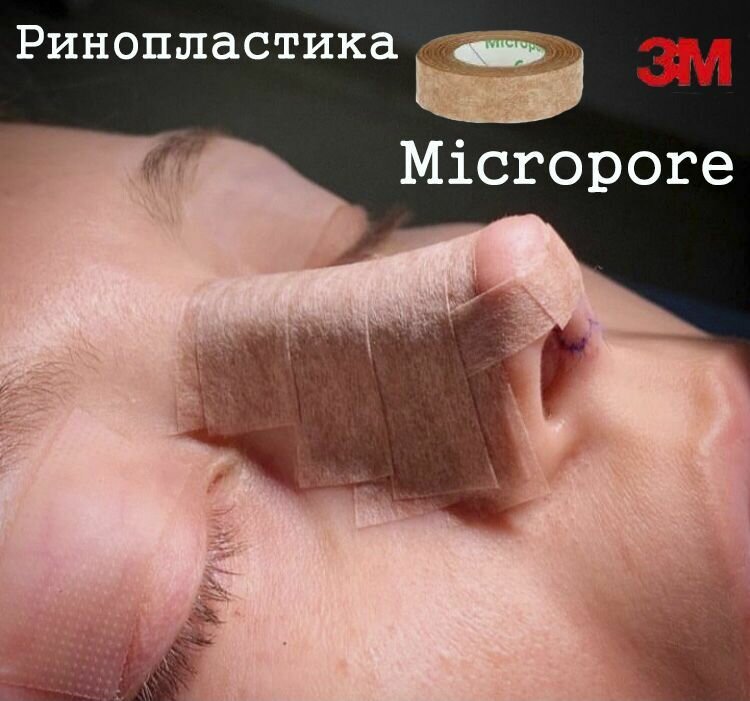 Тейп ринопластика Micropore 3M, бинт косметологический 1шт