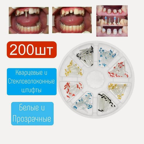 Изображение товара Штифты стекловолоконные , Фибрапост ( Fibrapost ) , Набор Post Kit : 200 шт , размеры с 1.0 по 1.8 mm, Штифты Стоматологические Стекловолоконные от Dentalrus