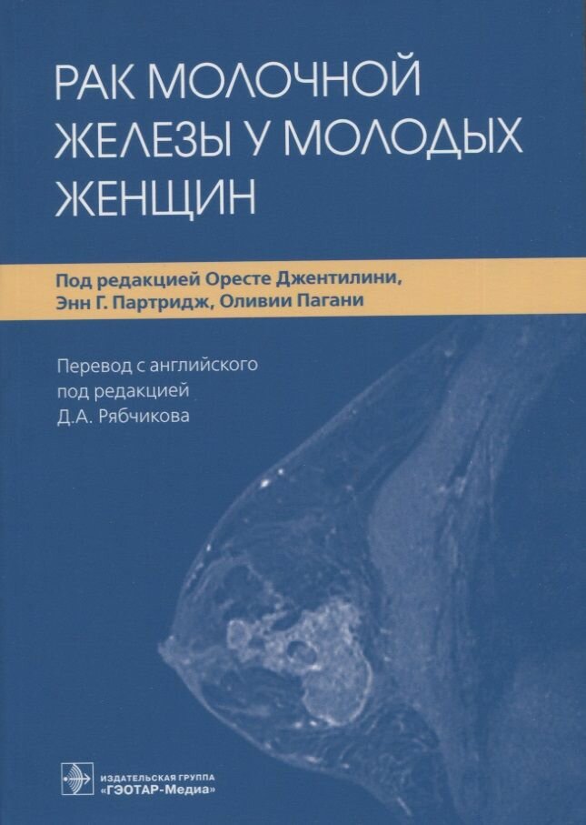 Рак молочной железы у молодых женщин