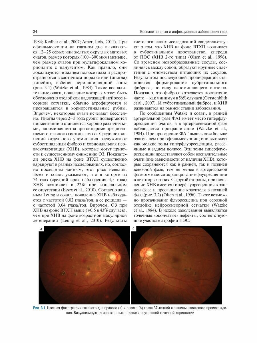 Воспалительные и инфекционные заболевания глаз - фото №5