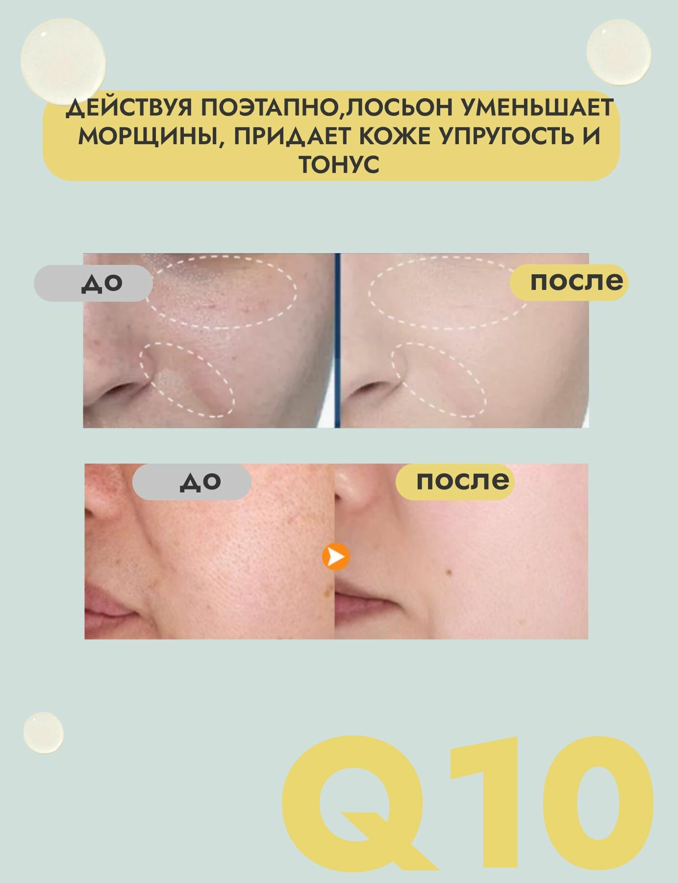 Лосьоны Для Лица Крем для лица, Лосьон для лица, С коэнзимом Q10, 130 мл