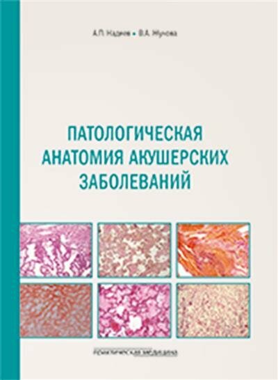 Интерпретация биопсий молочной железы - фото №4