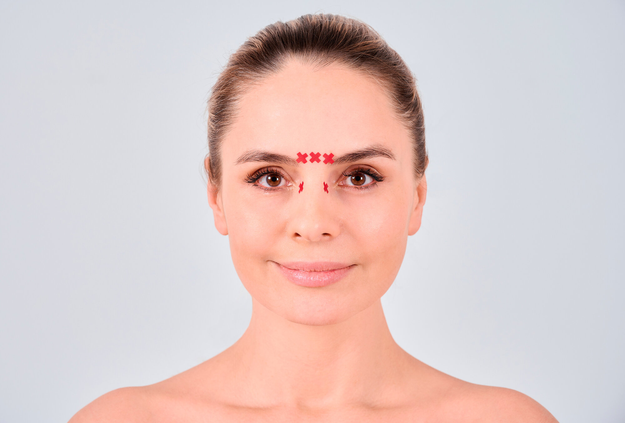BBalance ACU TAPE, аку тейпы для локальной стимуляции точек и рецепторов организма. Уровень фиксации 4. Размер 1см*1см, 640 шт/уп, цвет бежевый — фото 1