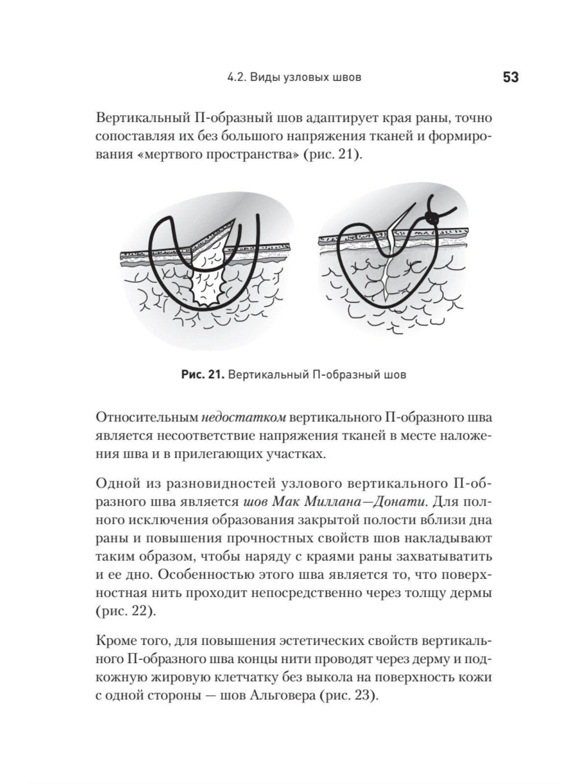 Хирургический шов, 3 издание обновленное - фото №9