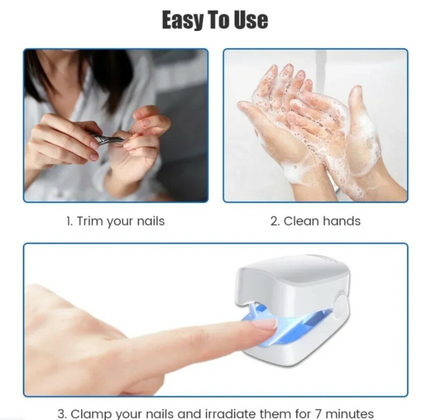 Миостимуляторы Аппарат для очистки ногтевой пластины Nail Fungus Cleaning Laser Device, для рук, ног, от грибка ногтей, беспроводной